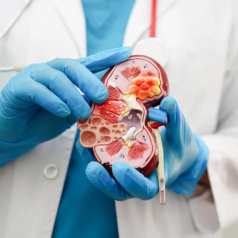 When PCNL is needed?