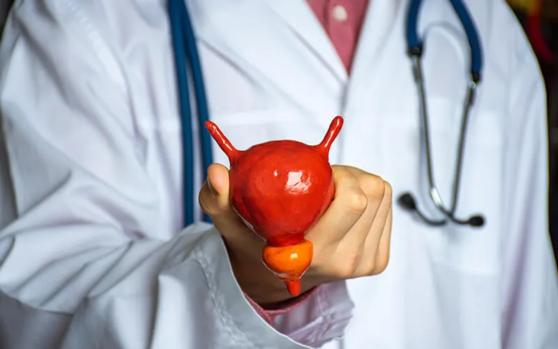 What are Prostate Stones?