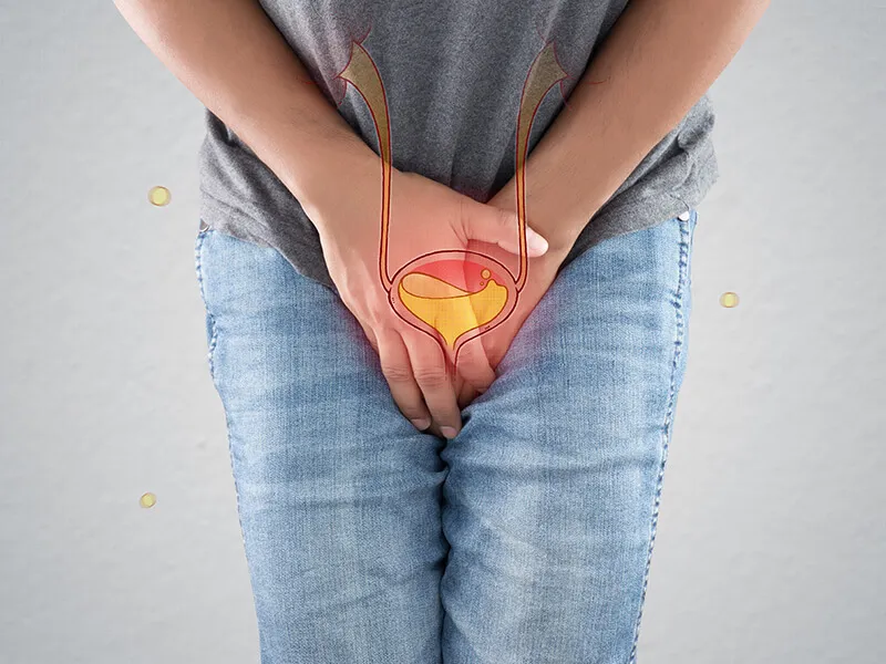 What are Urinary Bladder Stones?