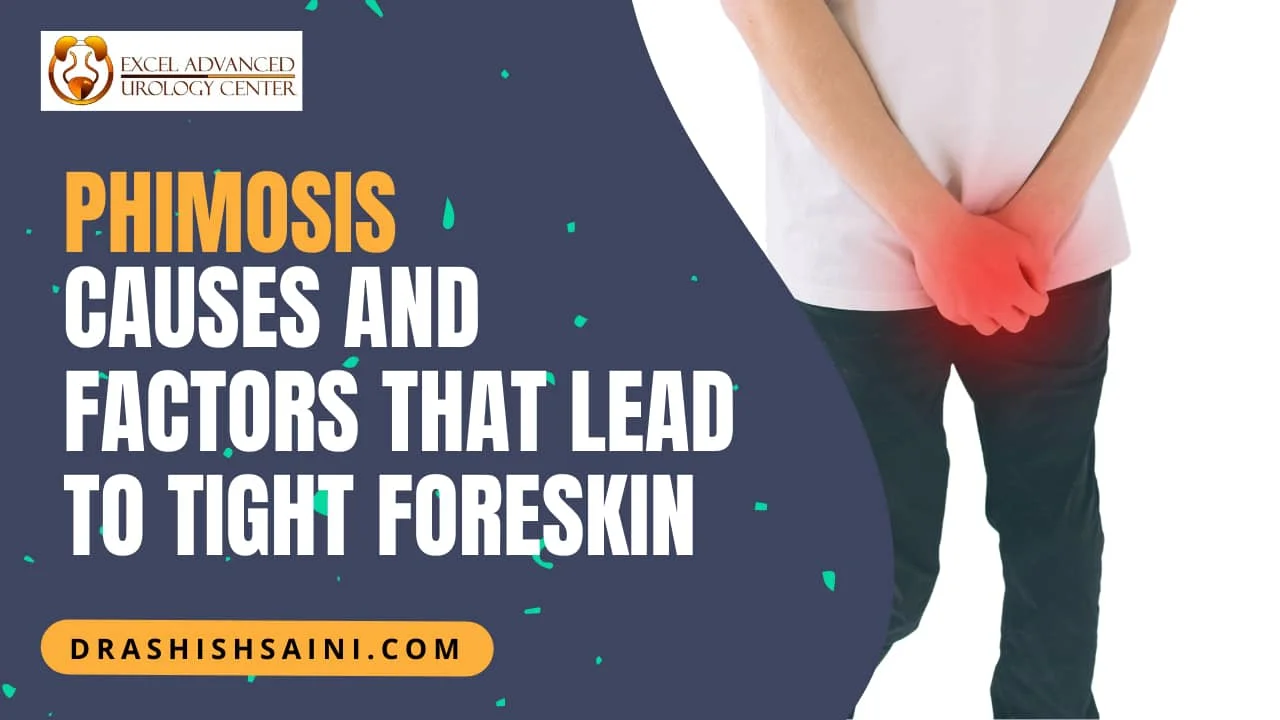Phimosis symptoms:- Causes and Factors that lead to a Tight Foreskin