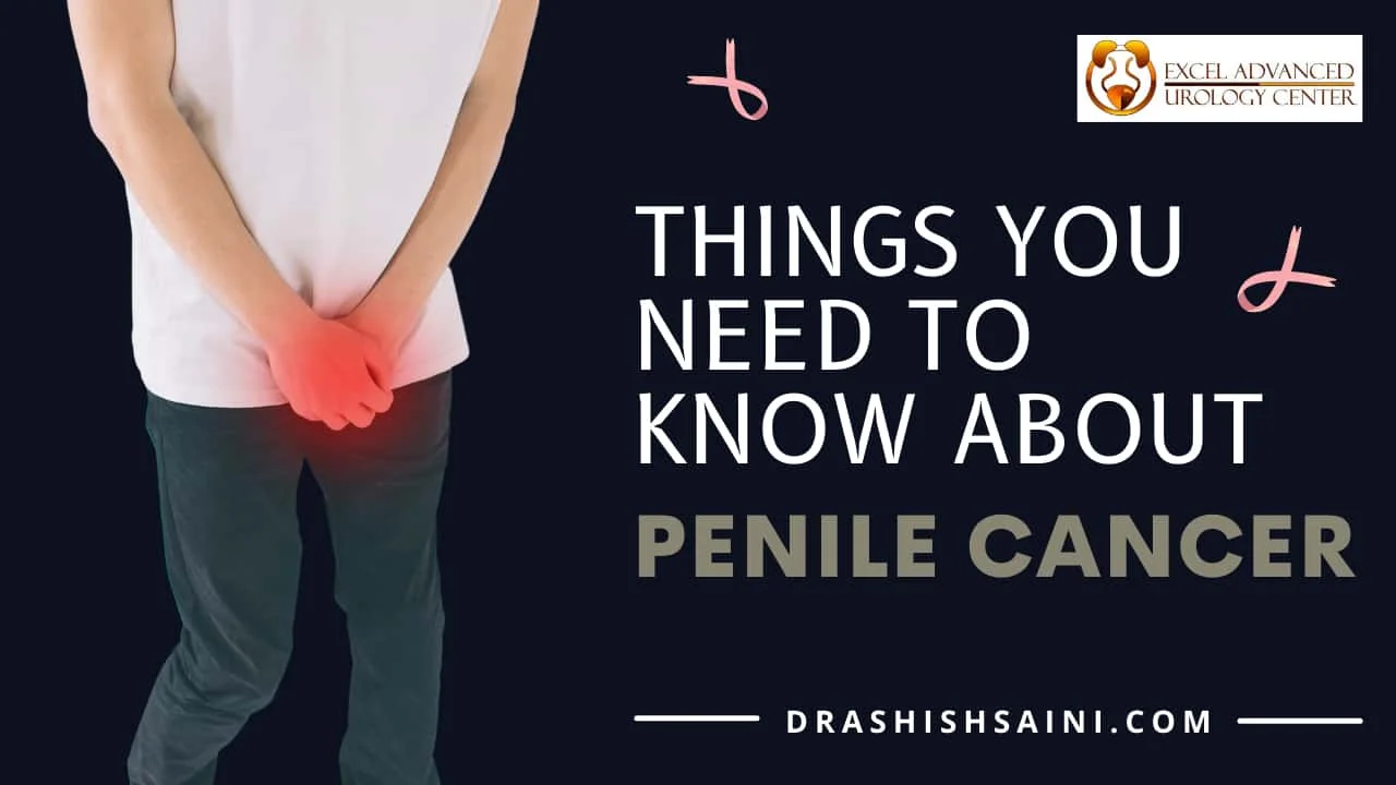 THINGS YOU NEED TO KNOW ABOUT PENILE CANCER