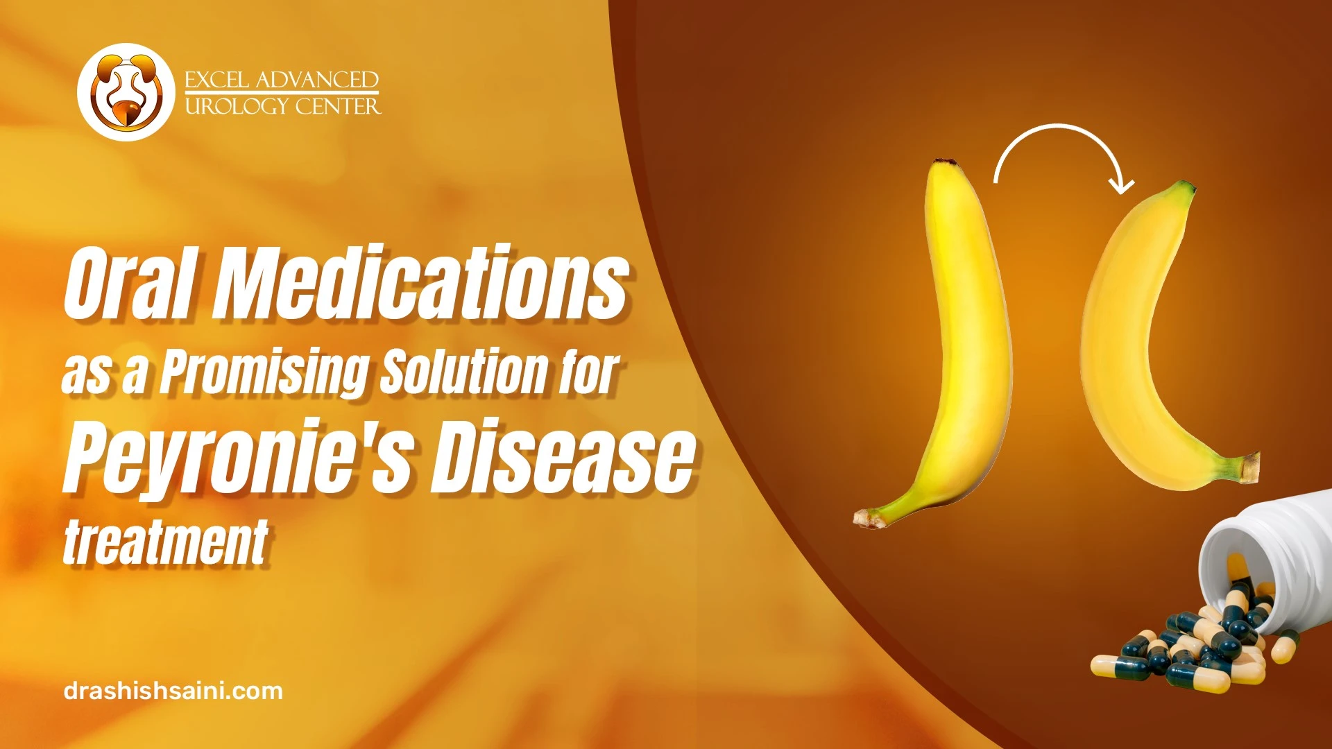Oral Medications as a Promising Solution for Peyronie's Disease Treatment